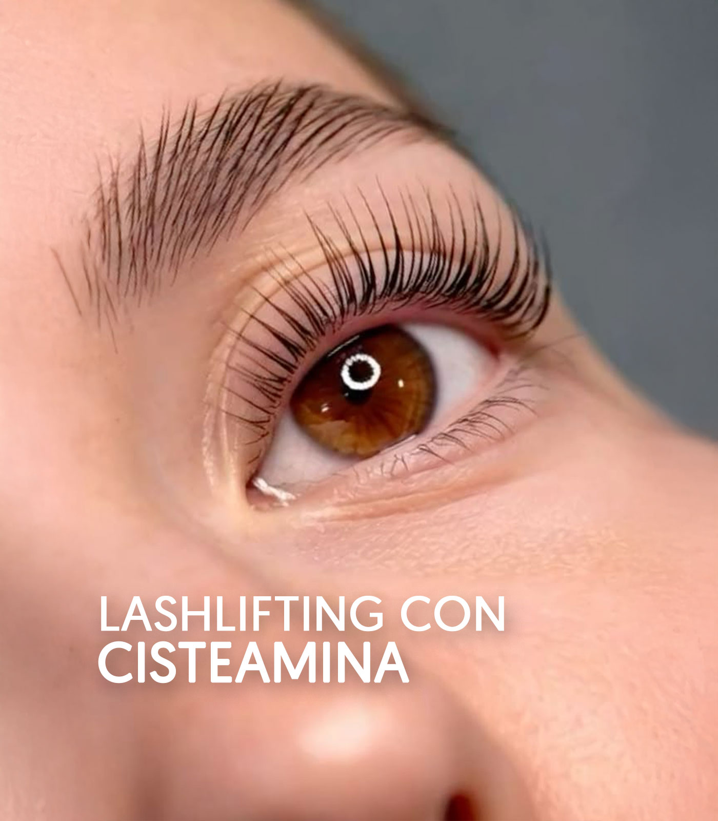 Qué es el Kit Amino